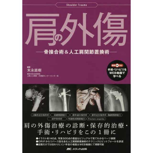 肩の外傷　骨接合術＆人工肩関節置換術