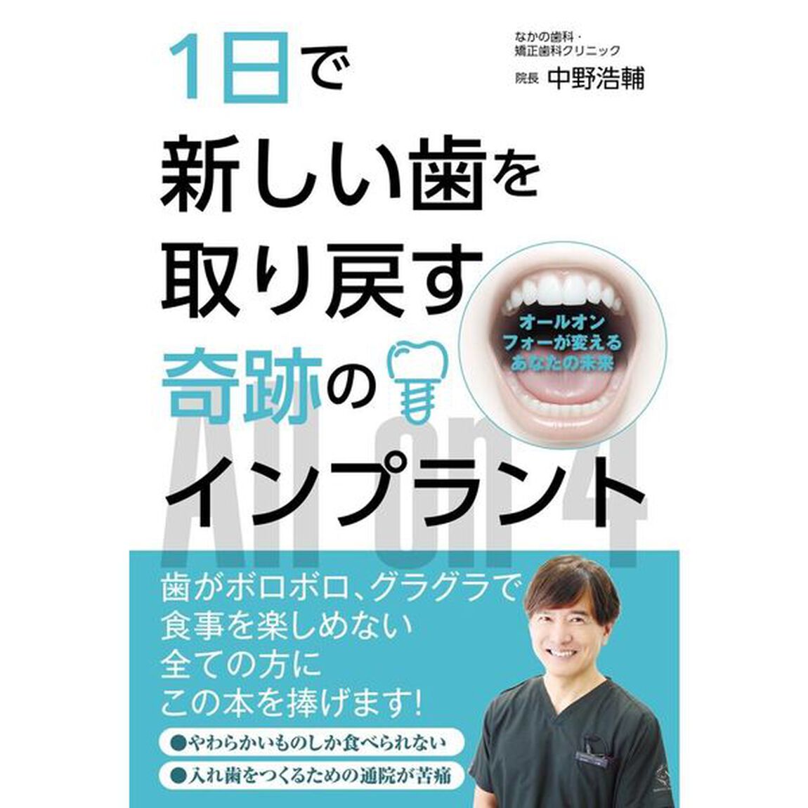 １日で新しい歯を取り戻す奇跡のインプラント　オールオンフォーが変えるあなたの未来