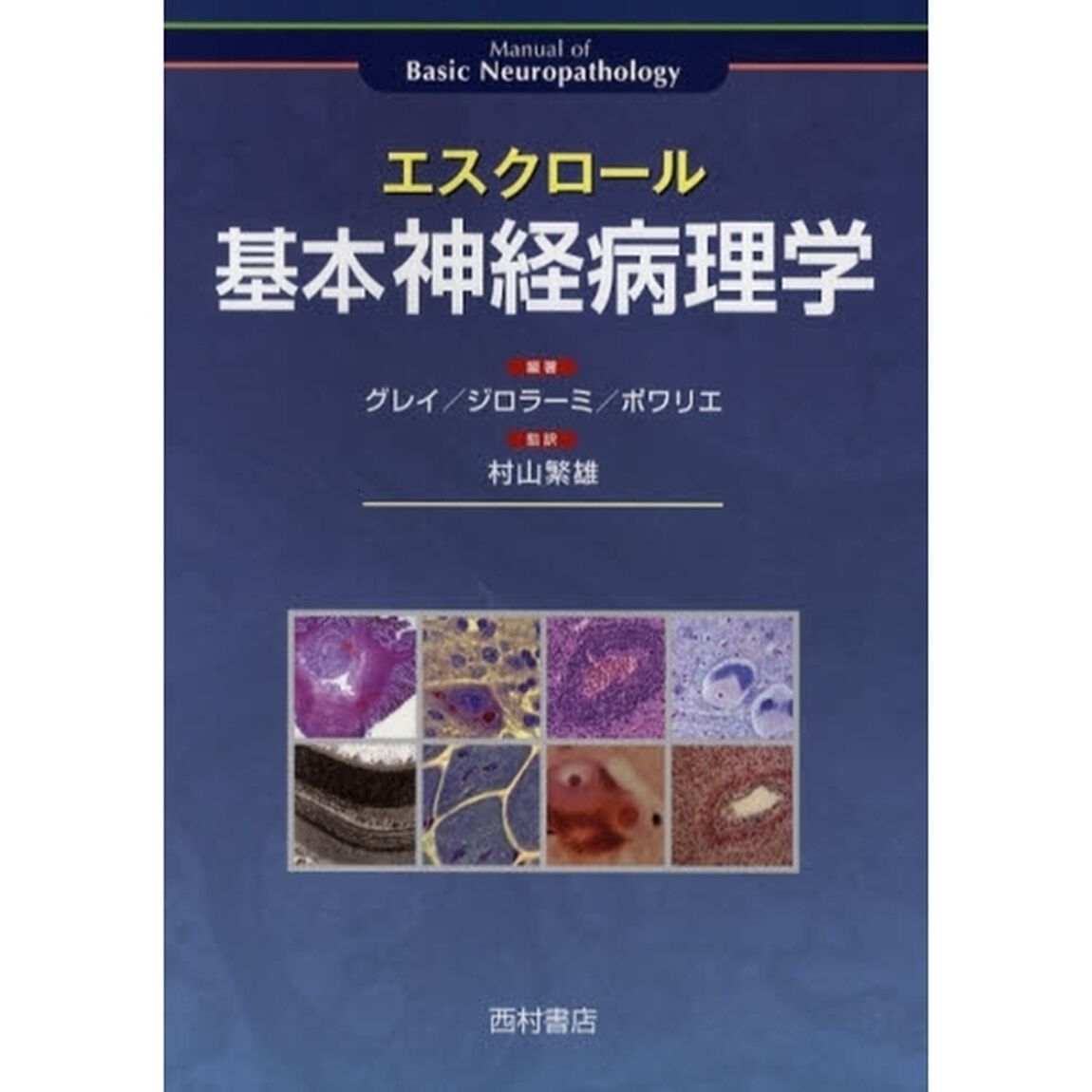 エスクロール基本神経病理学