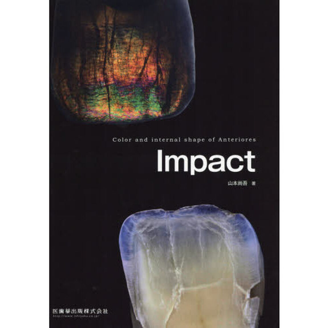 Ｉｍｐａｃｔ　Ｃｏｌｏｒ　ａｎｄ　ｉｎｔｅｒｎａｌ　ｓｈａｐｅ　ｏｆ　Ａｎｔｅｒｉｏｒｅｓ