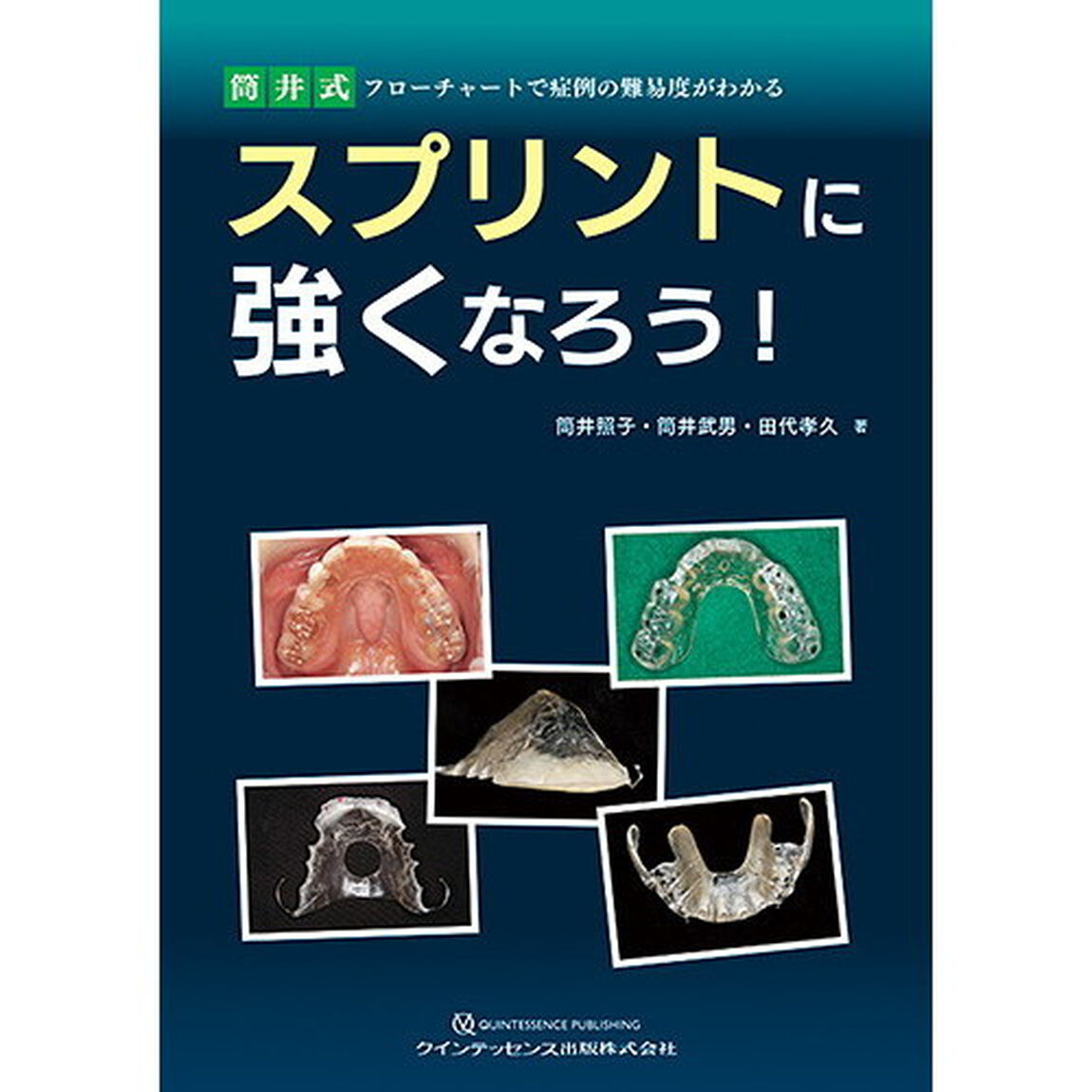スプリントに強くなろう！　筒井式フローチャートで症例の難易度がわかる