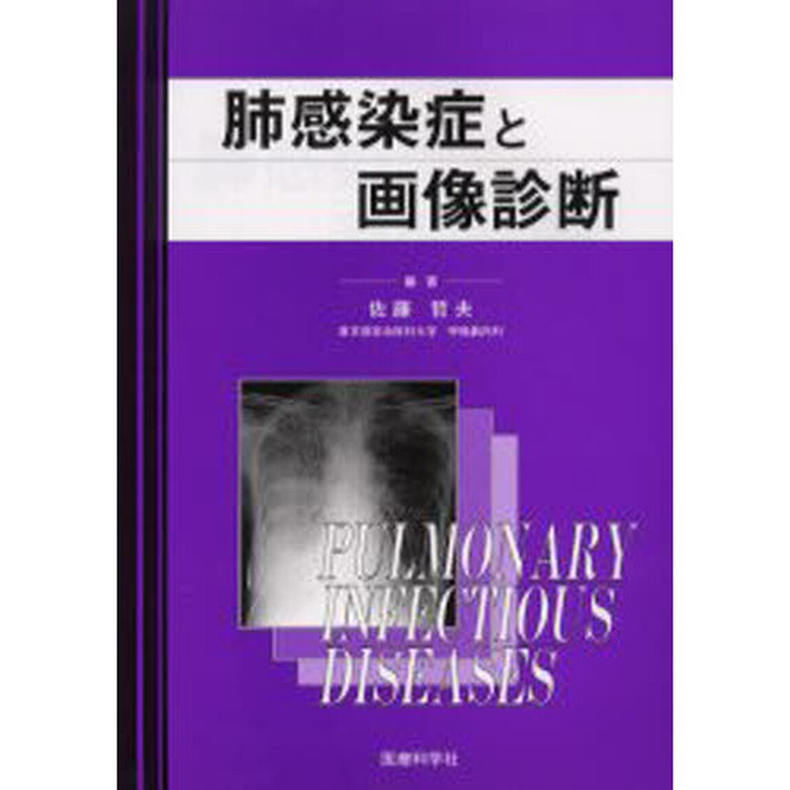 肺感染症と画像診断