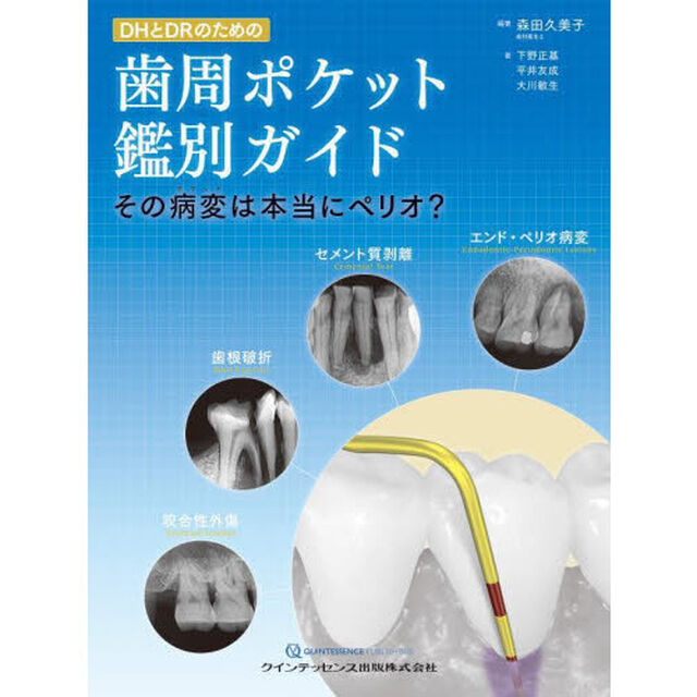 ＤＨとＤＲのための歯周ポケット鑑別ガイド　その病変は本当にペリオ？