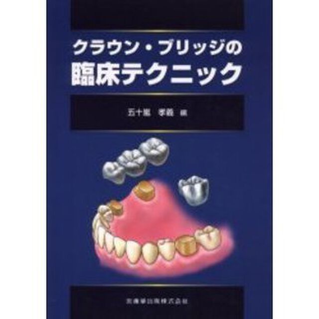 クラウン・ブリッジの臨床テクニック