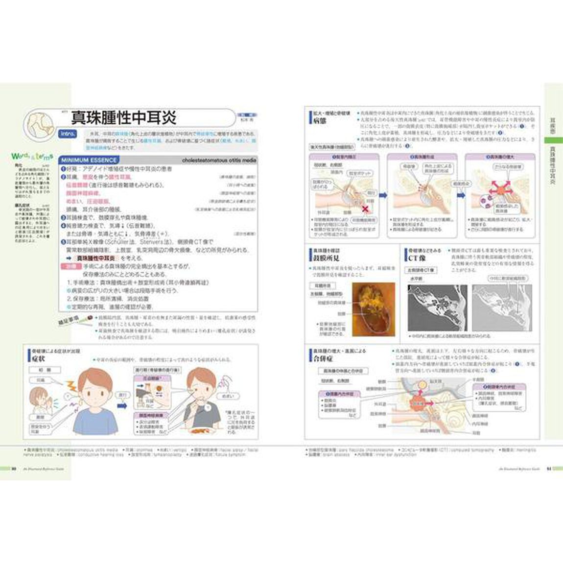 病気がみえるvol.13 耳鼻咽喉科「耳鼻咽喉科」