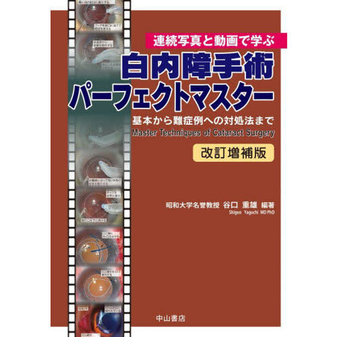 白内障手術パーフェクトマスター　連続写真と動画で学ぶ　基本から難症例への対処法まで「改訂増補版」