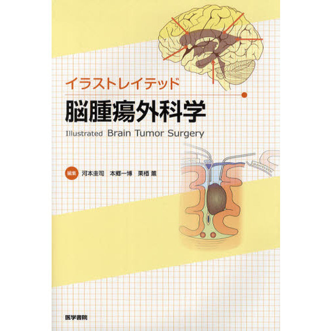 イラストレイテッド脳腫瘍外科学