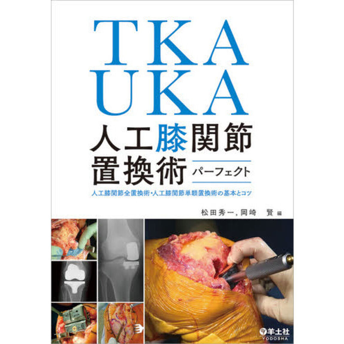 ＴＫＡ・ＵＫＡ人工膝関節置換術パーフェクト　人工膝関節全置換術・人工膝関節単顆置換術の基本とコツ