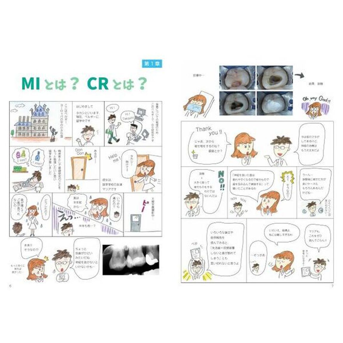 マンガで学ぶコンポジットレジン修復に役立つ接着の基礎知識
