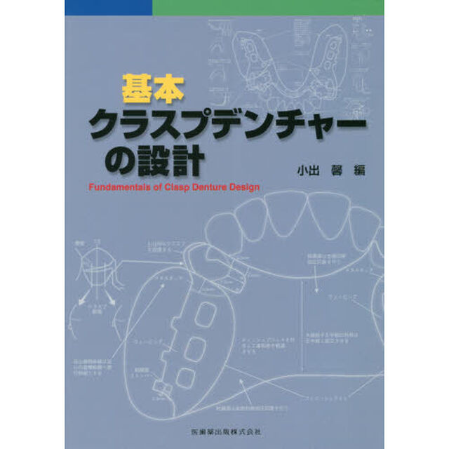 基本クラスプデンチャーの設計