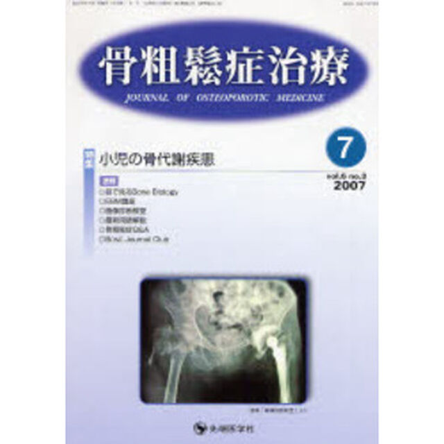 骨粗鬆症治療　Ｖｏｌ．６Ｎｏ．３（２００７－７）「特集小児の骨代謝疾患」