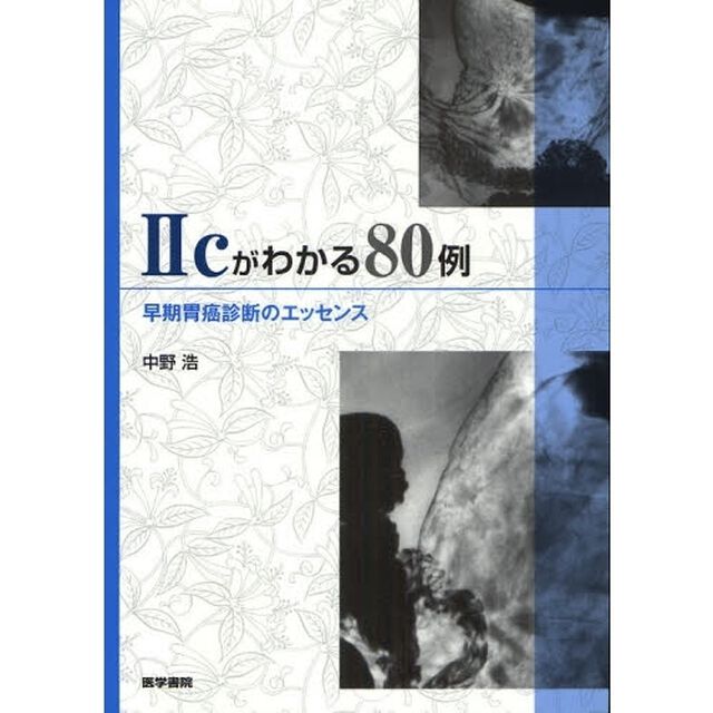 ２ｃがわかる８０例　早期胃癌診断のエッセンス