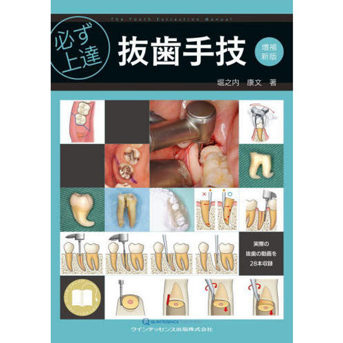 必ず上達抜歯手技「増補新版」