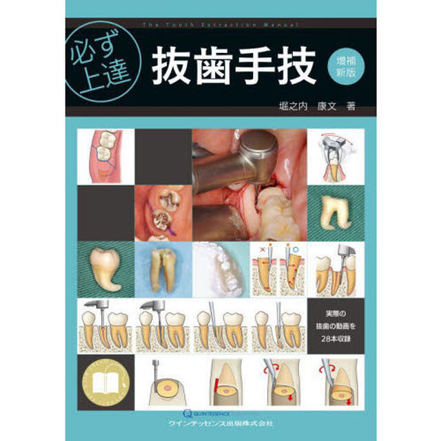 必ず上達抜歯手技「増補新版」