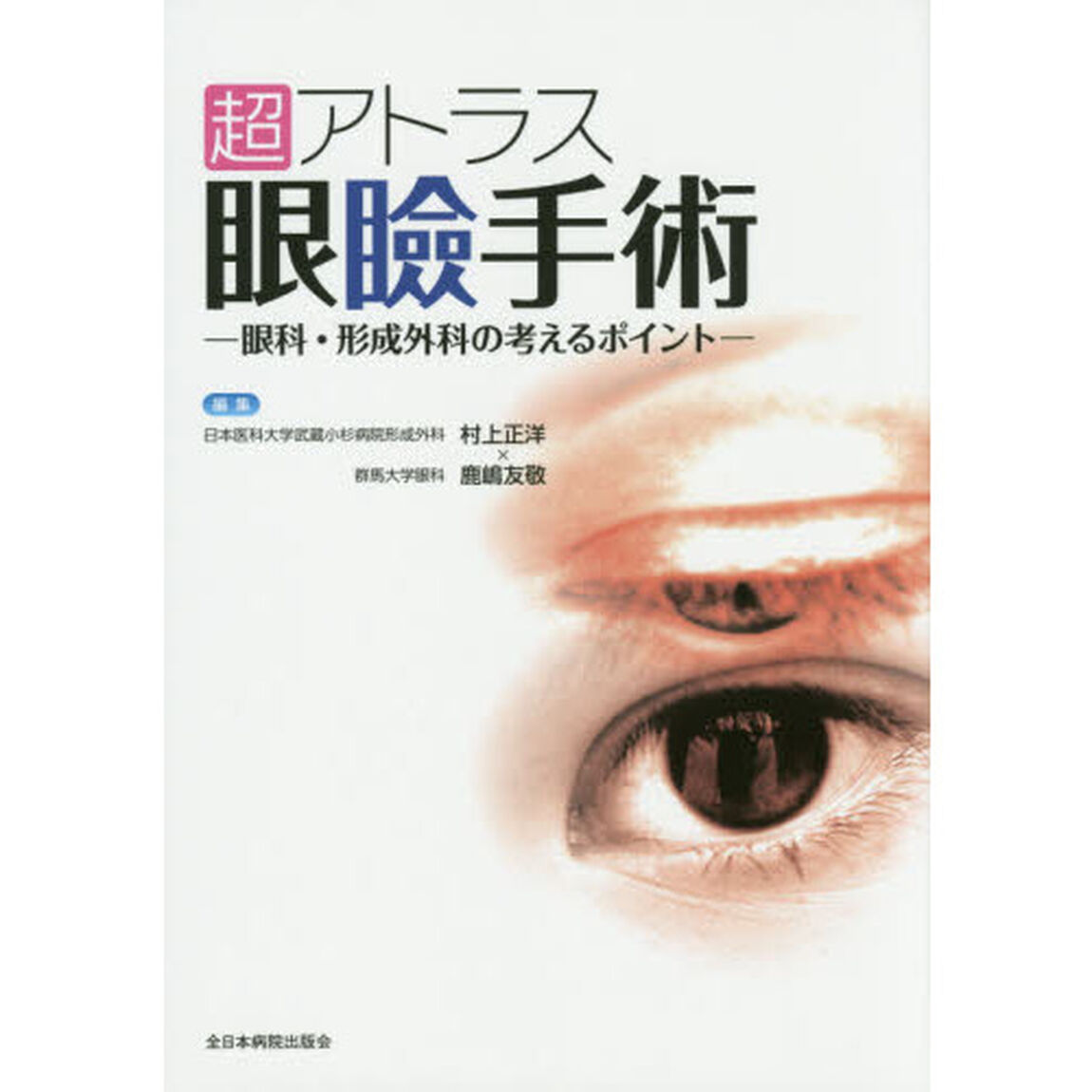 超アトラス眼瞼手術　眼科・形成外科の考えるポイント