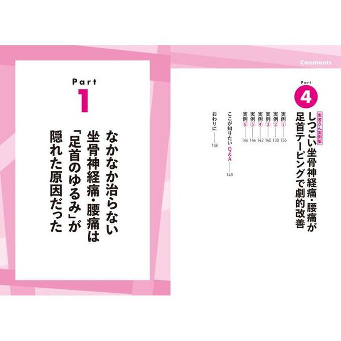 しつこい坐骨神経痛腰痛は足首テーピングでよくなる
