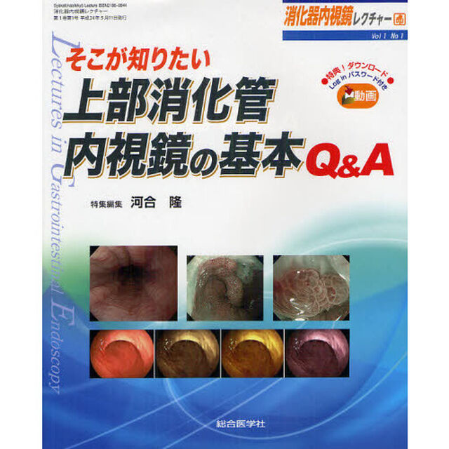 消化器内視鏡レクチャー　Ｖｏｌ１Ｎｏ１（２０１２）「そこが知りたい上部消化管内視鏡の基本Ｑ＆Ａ」