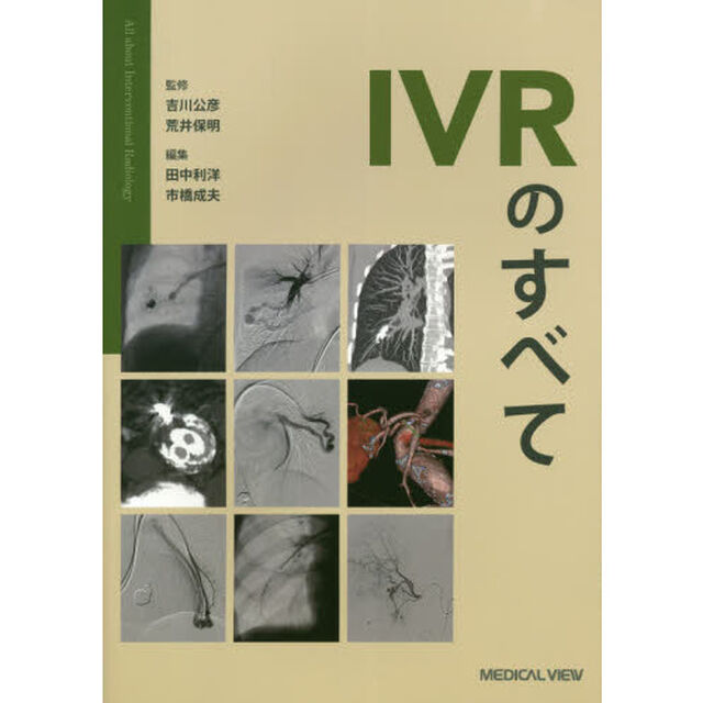 ＩＶＲのすべて