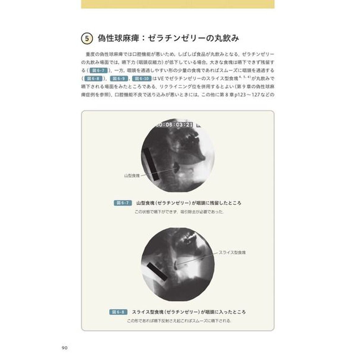 目でみる嚥下障害