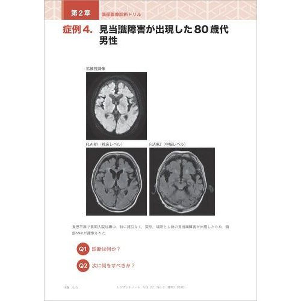 画像診断ドリル　救急医と放射線科医が伝授する適切なオーダーと読影法