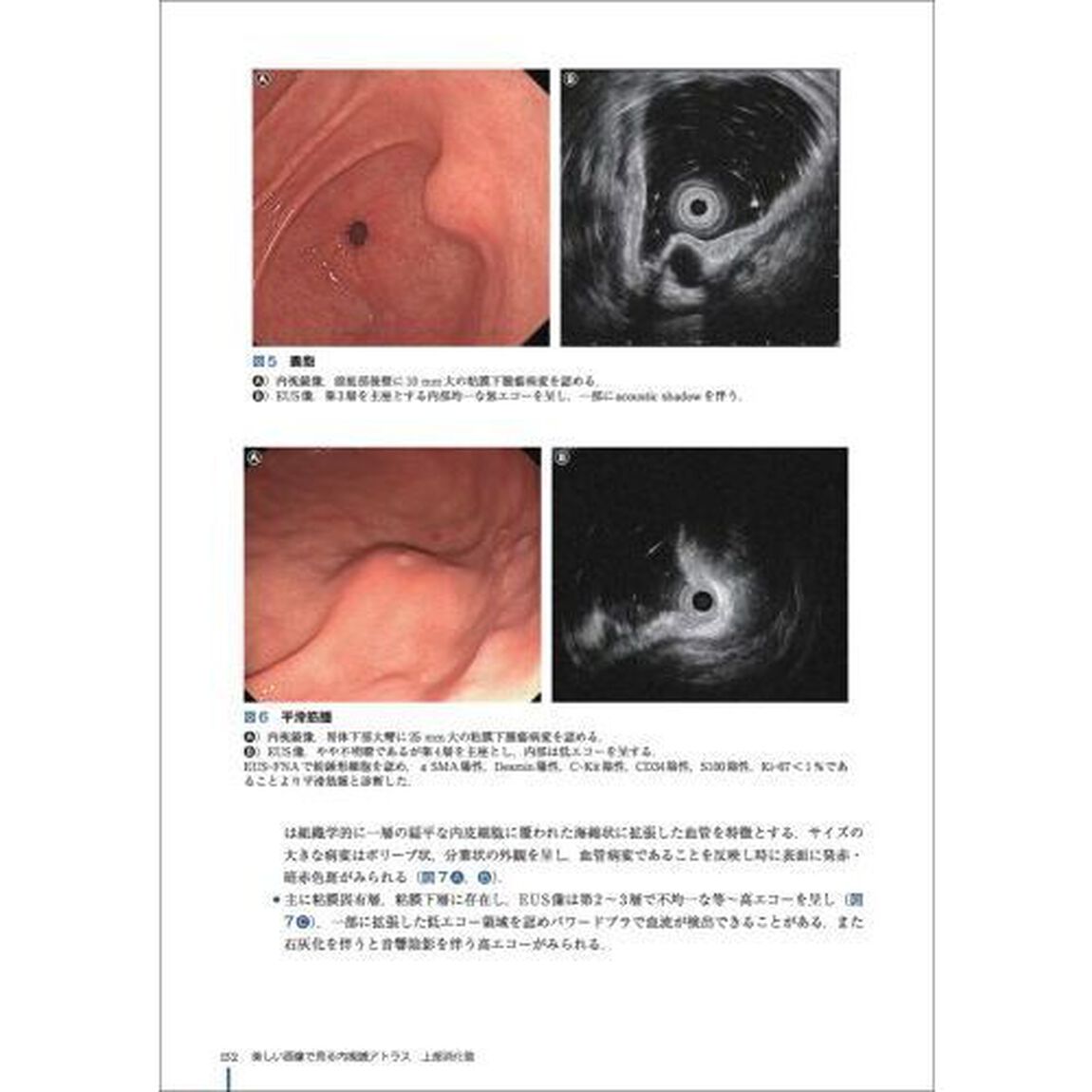 美しい画像で見る内視鏡アトラス上部消化管　腫瘍から感染性・炎症性疾患まで、典型例とピットフォール画像で鑑別点を理解する