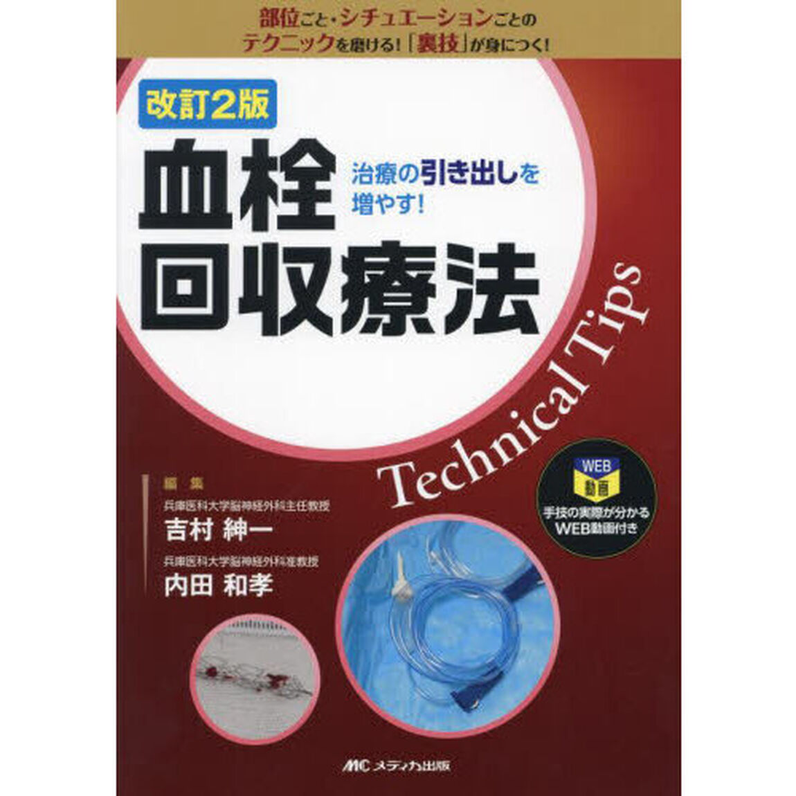 血栓回収療法Ｔｅｃｈｎｉｃａｌ　Ｔｉｐｓ　治療の引き出しを増やす！「改訂２版」