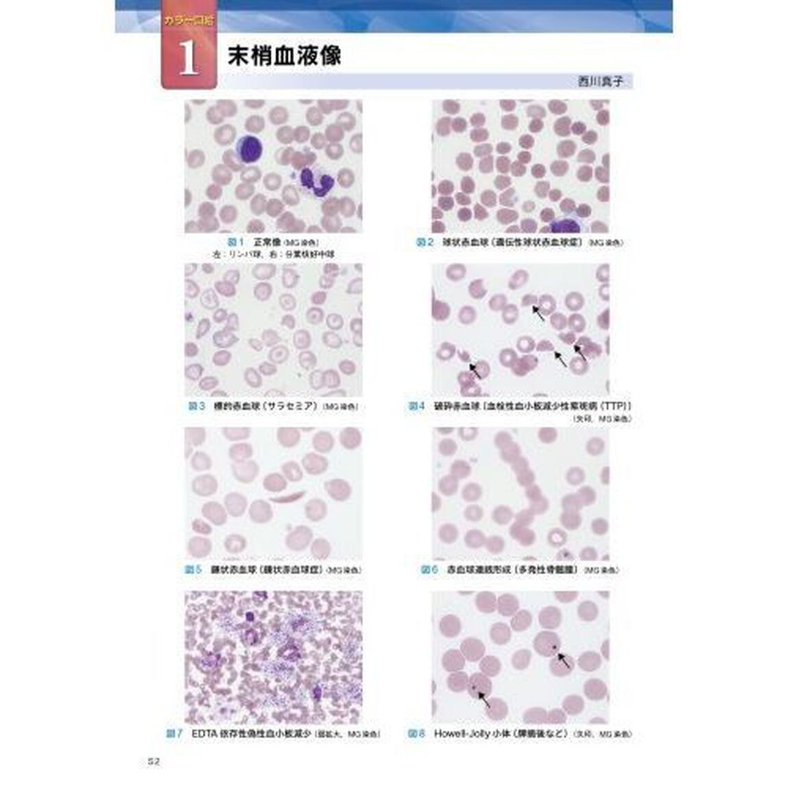臨床検査を使いこなす