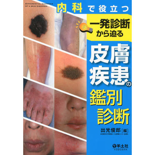 内科で役立つ一発診断から迫る皮膚疾患の鑑別診断