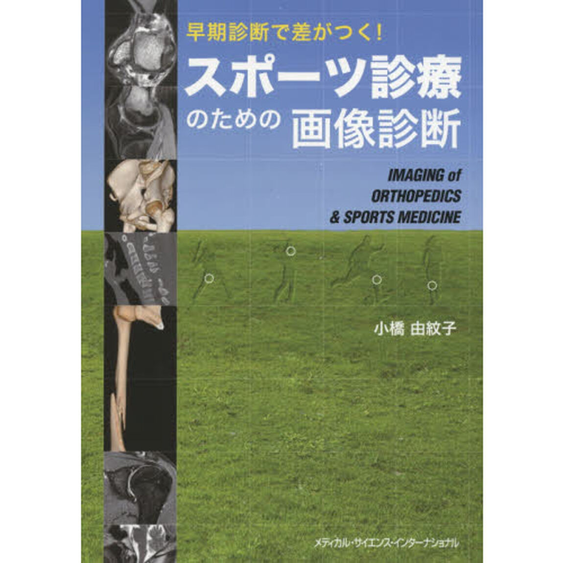 スポーツ診療のための画像診断　早期診断で差がつく！