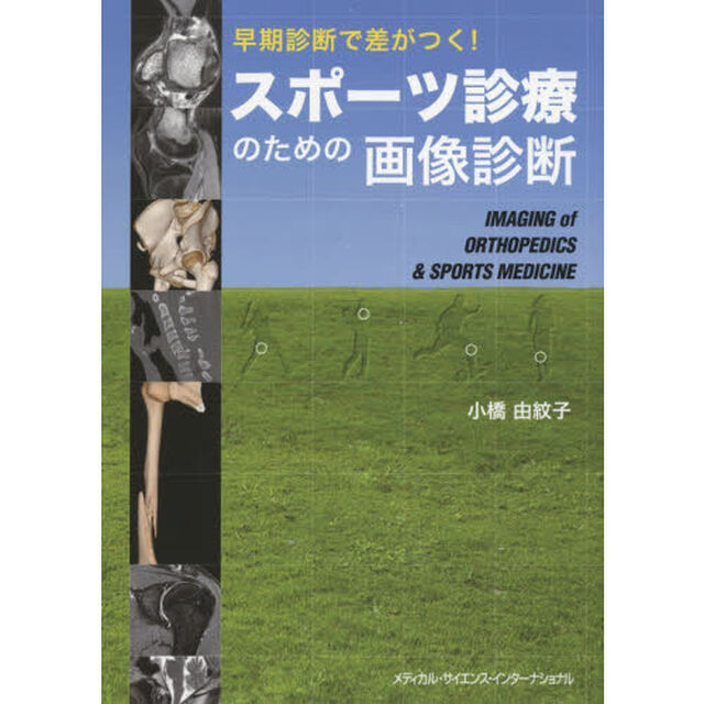 スポーツ診療のための画像診断　早期診断で差がつく！