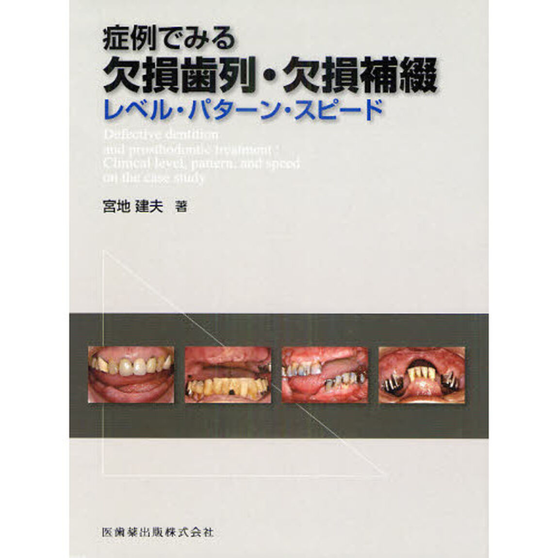 症例でみる欠損歯列・欠損補綴　レベル・パターン・スピード