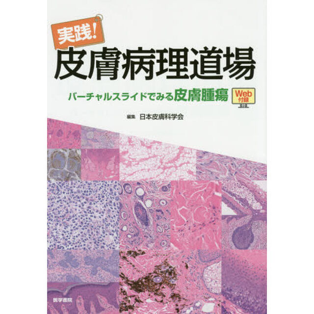 実践！皮膚病理道場　バーチャルスライドでみる皮膚腫瘍