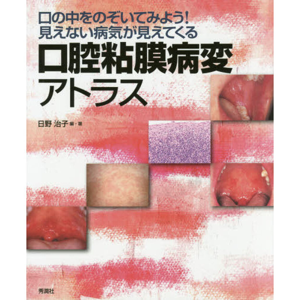 口腔粘膜病変アトラス　口の中をのぞいてみよう！見えない病気が見えてくる