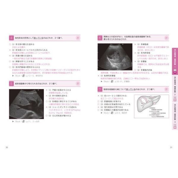 超音波検査士認定試験対策 過去問分析〜出題のポイントで学ぶ！ 臨床編