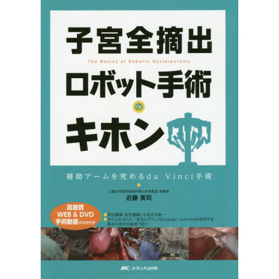 子宮全摘出ロボット手術のキホン　補助アームを究めるｄａ　Ｖｉｎｃｉ手術