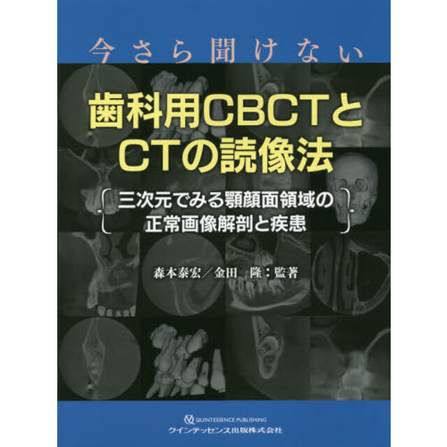 今さら聞けない歯科用ＣＢＣＴとＣＴの読像法　三次元でみる顎顔面領域の正常画像解剖と疾患