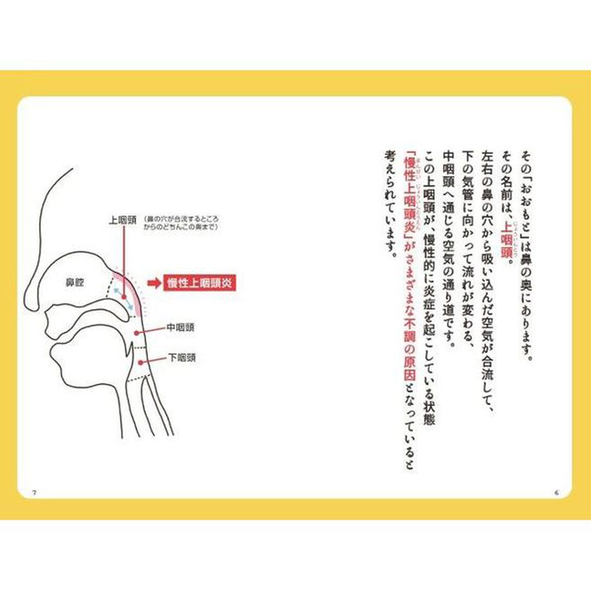 つらい不調が続いたら慢性上咽頭炎を治しなさい