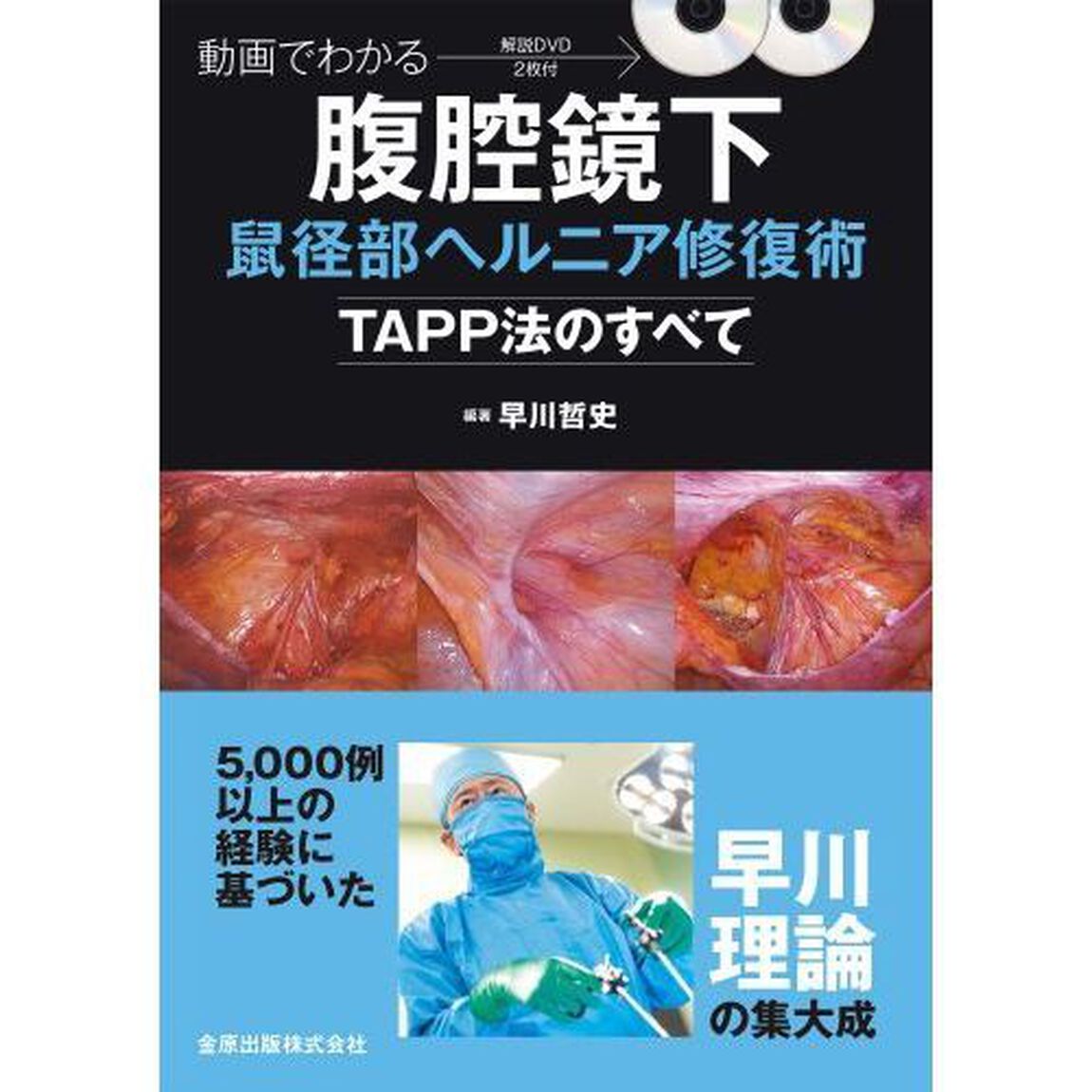 動画でわかる腹腔鏡下鼠径部ヘルニア修復術　ＴＡＰＰ法のすべて