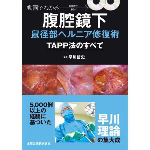 動画でわかる腹腔鏡下鼠径部ヘルニア修復術　ＴＡＰＰ法のすべて