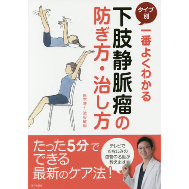 一番よくわかるタイプ別下肢静脈瘤の防ぎ方・治し方