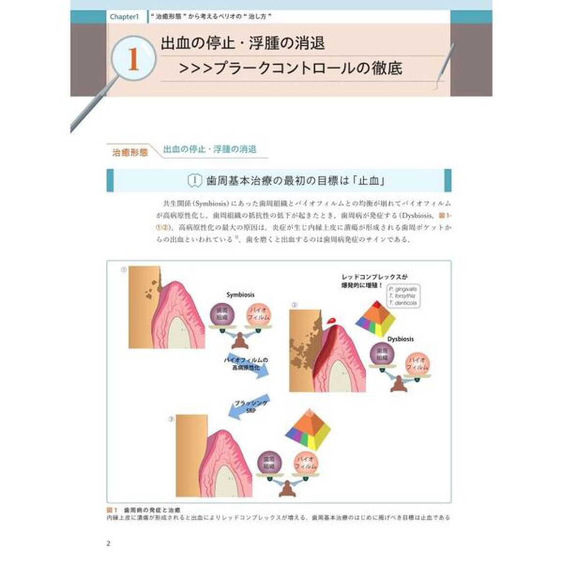 歯科医師・歯科衛生士のための ペリオの治癒形態と治し方