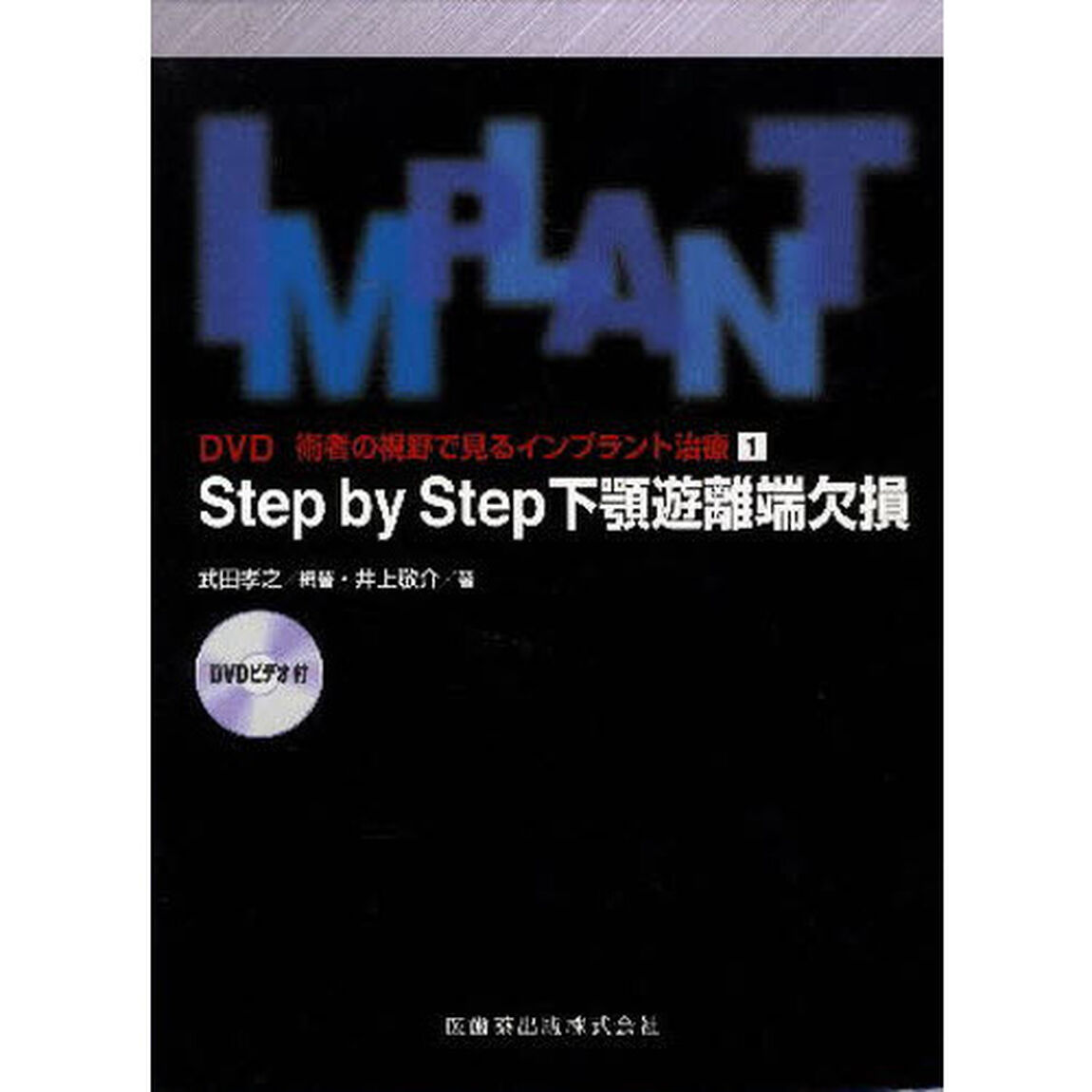 Ｓｔｅｐ　ｂｙ　Ｓｔｅｐ　下顎遊離端欠損