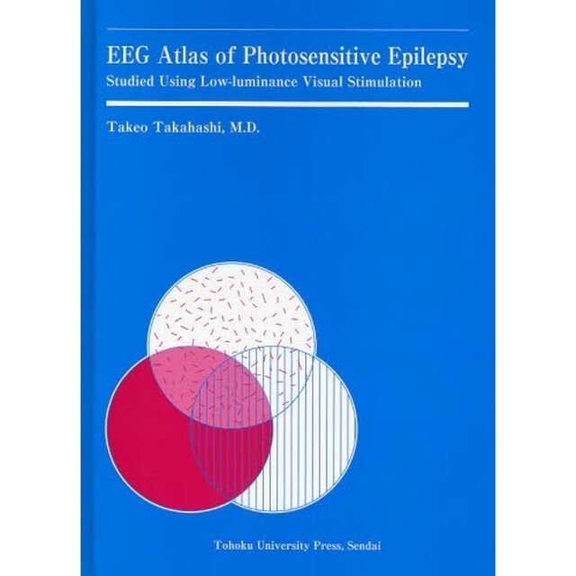 ＥＥＧ　Ａｔｌａｓ　ｏｆ　Ｐｈｏｔｏｓｅｎｓｉｔｉｖｅ　Ｅｐｉｌｅｐｓｙ　Ｓｔｕｄｉｅｄ　Ｕｓｉｎｇ　Ｌｏｗ‐ｌｕｍｉｎａｎｃｅ　Ｖｉｓｕａｌ　Ｓｔｉｍｕｌａｔｉｏｎ