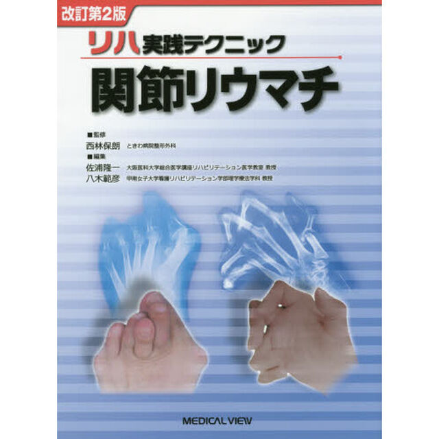関節リウマチ「改訂第２版」