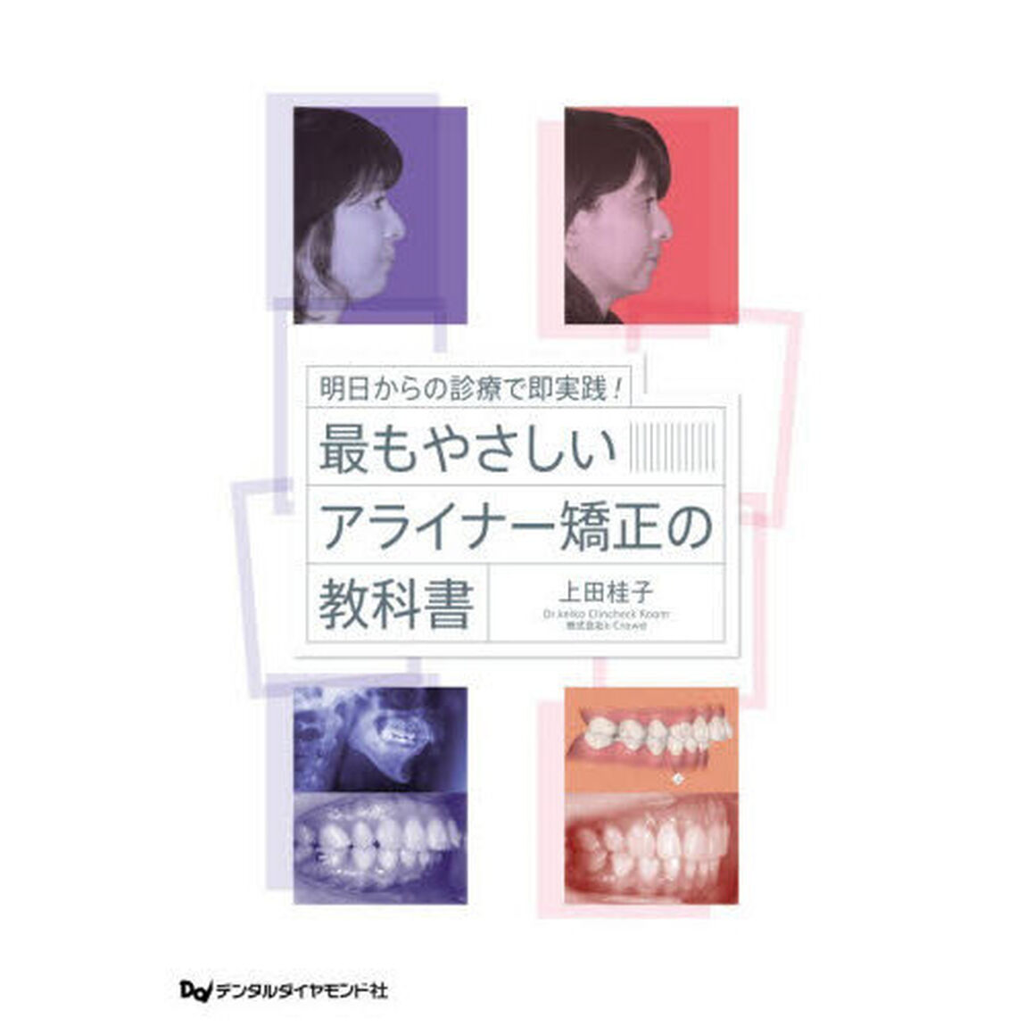 明日からの診療で即実践！最もやさしいアライナー矯正の教科書