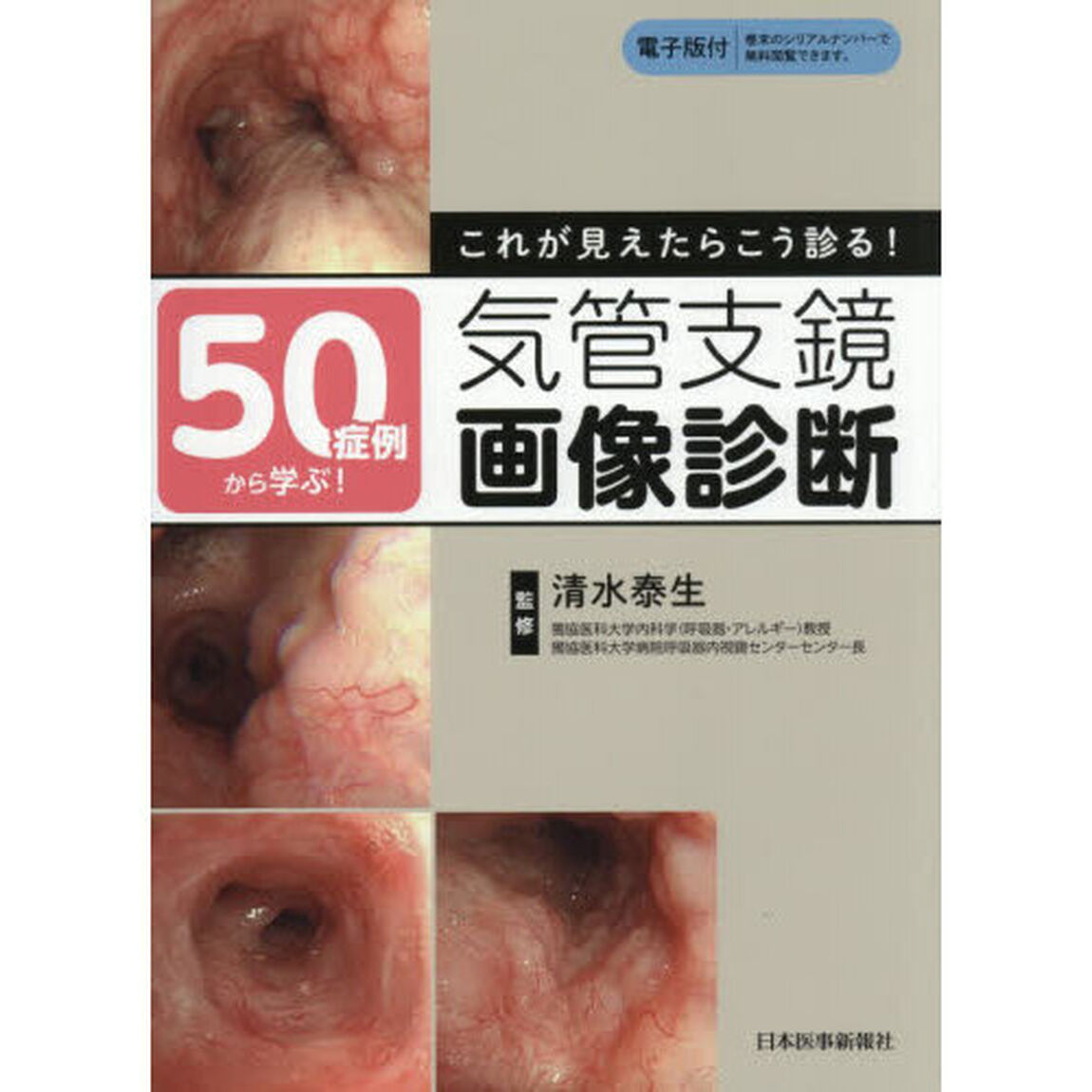 ５０症例から学ぶ！これが見えたらこう診る！気管支鏡画像診断