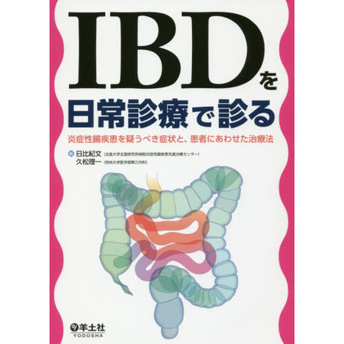 ＩＢＤを日常診療で診る　炎症性腸疾患を疑うべき症状と、患者にあわせた治療法