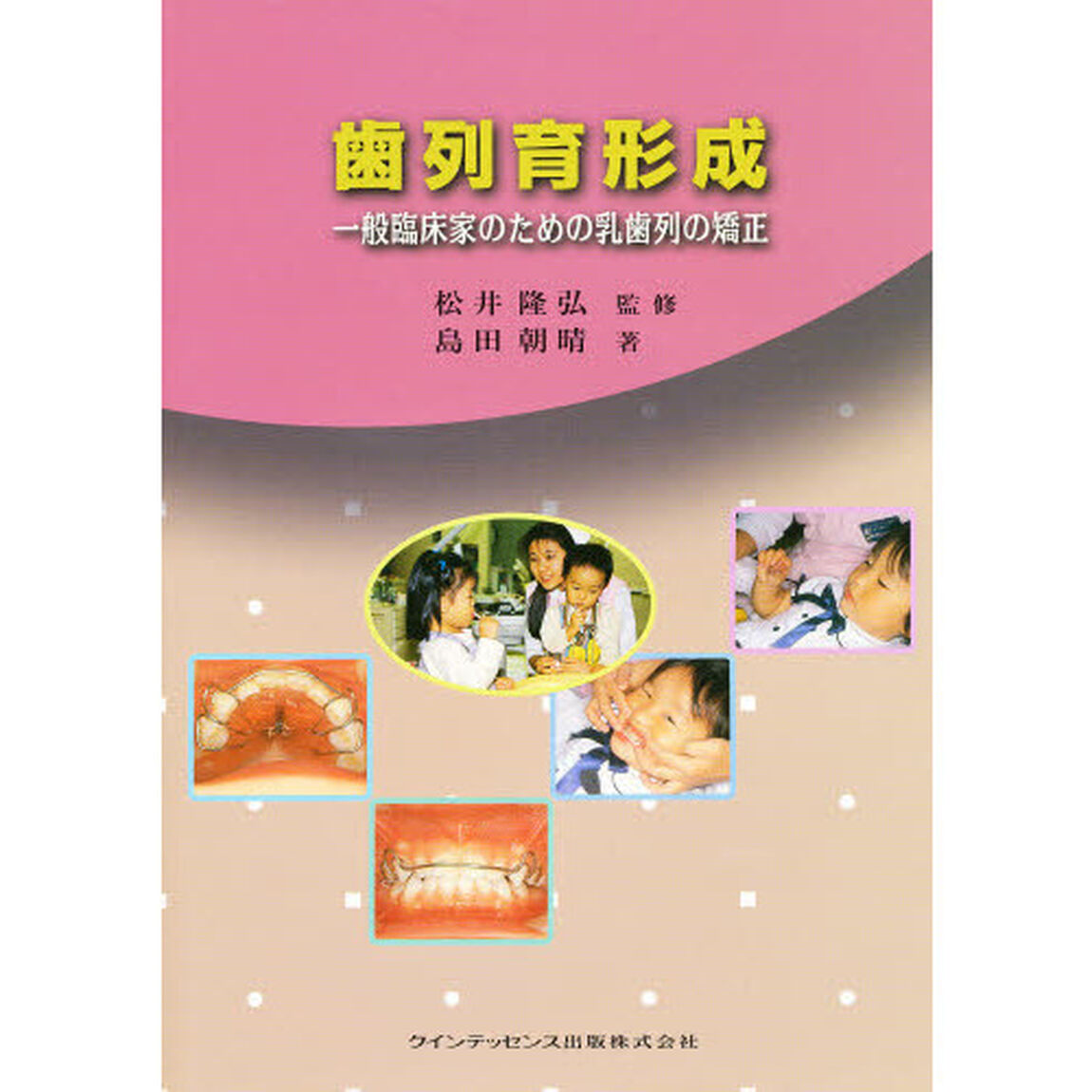 歯列育形成　一般臨床家のための乳歯列の矯正