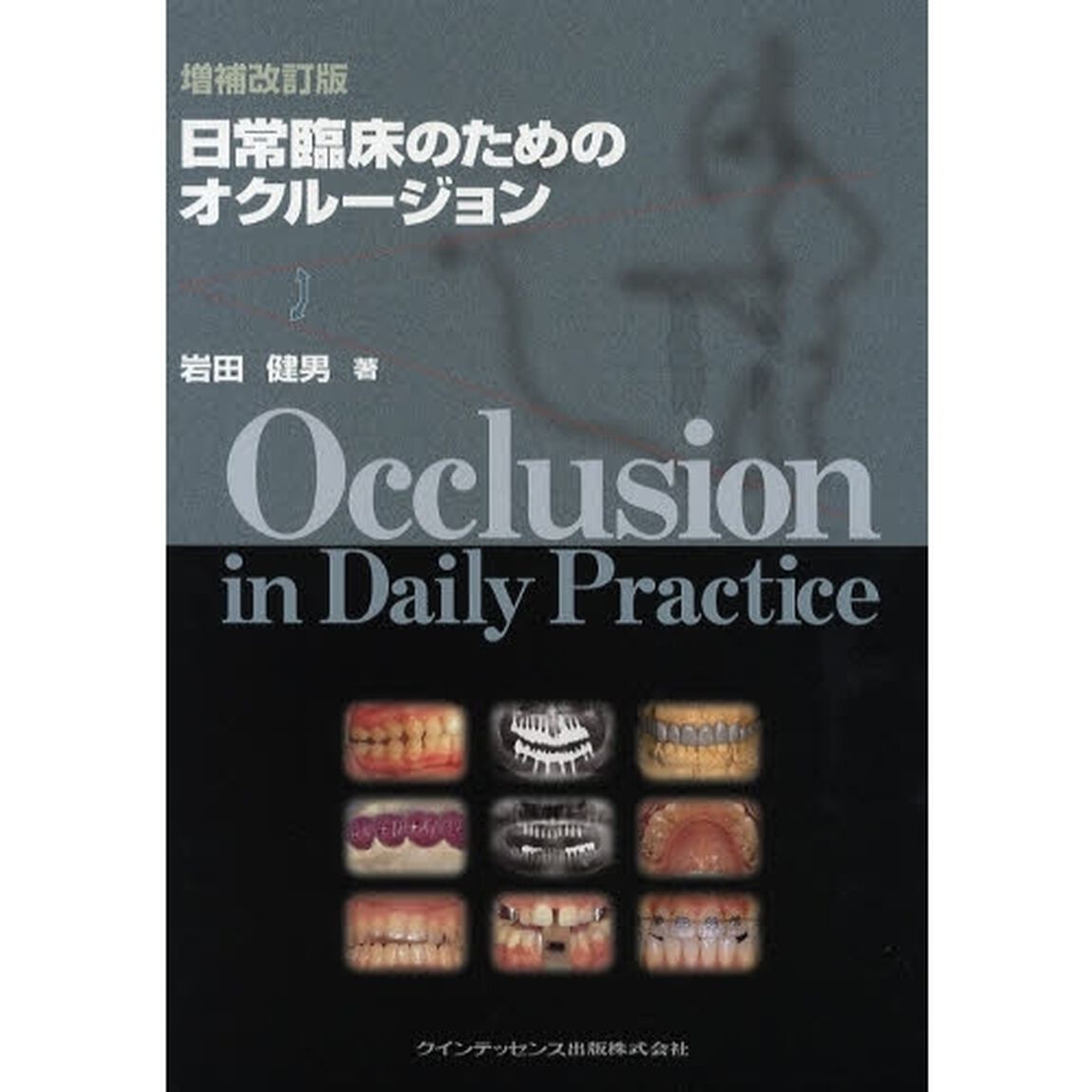 日常臨床のためのオクルージョン「増補改訂版」