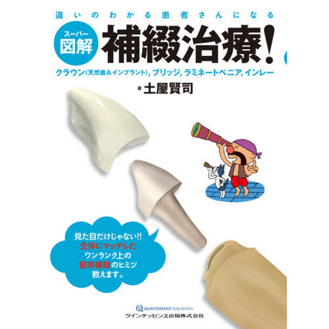 スーパー図解補綴治療！　クラウン〈天然歯＆インプラント〉，ブリッジ，ラミネートべニア，インレー　違いのわかる患者さんになる
